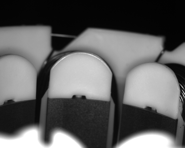 機(jī)器視覺(jué)字符缺陷檢測(cè)